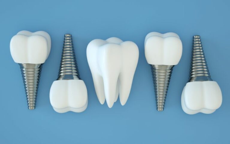 fake dental implants on a blue background